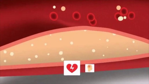 ������ �����: ��� �������� ���������� �� �������� � ������ �����������