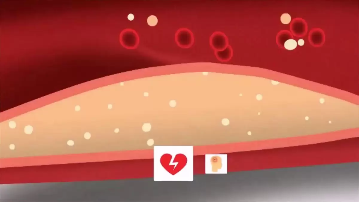 Ночной голод: как привычка отразилась на здоровье и уровне холестерина